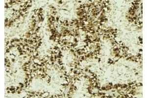 ABIN6273146 at 1/100 staining Human lung tissue by IHC-P. (NUFIP1 antibody  (Internal Region))