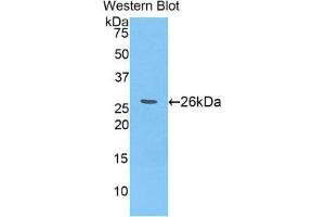 Western Blotting (WB) image for anti-Spectrin alpha Chain, Brain (SPTAN1) (AA 2082-2288) antibody (ABIN1860627) (SPTAN1 antibody  (AA 2082-2288))