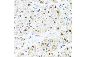 Immunohistochemistry of paraffin-embedded human stomach using BCCIP antibody. (BCCIP antibody)