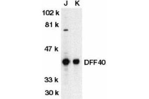 Western blot analysis of DFF40 in Jurkat (J) and K562 (K) whole cell lysate with DFF40 antibody at 2ug/ml. (DFFB antibody  (AA 3-18))