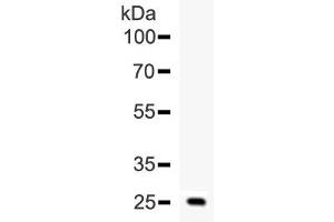 Western blot testing of human ESM1 recombinant protein (1ng/lane) with ESM1 antibody at 0. (ESM1 antibody  (AA 20-184))