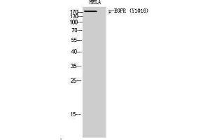 Western Blotting (WB) image for anti-Epidermal Growth Factor Receptor (EGFR) (pTyr1016) antibody (ABIN3179742) (EGFR antibody  (pTyr1016))