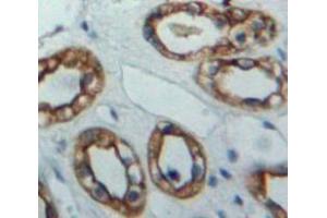 Used in DAB staining on fromalin fixed paraffin-embedded Kidney tissue (IKbIP antibody  (AA 132-314))