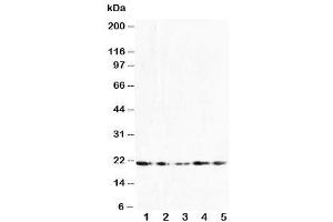 Western blot testing of FGF10 antibody and Lane 1:  U87 (FGF10 antibody  (N-Term))