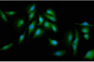 Immunofluorescence staining of Hela cells with ABIN7165702 at 1:133, counter-stained with DAPI. (PKC delta antibody  (AA 505-633))