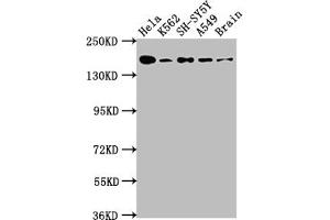 Western Blot Positive WB detected in: Hela whole cell lysate, K562 whole cell lysate, SH-SY5Y whole cell lysate, A549 whole cell lysate, Rat Brain whole cell lysate All lanes: APC antibody at 1:1000 Secondary Goat polyclonal to rabbit IgG at 1/50000 dilution Predicted band size: 312, 301, 309 kDa Observed band size: 160 kDa (Recombinant APC antibody)