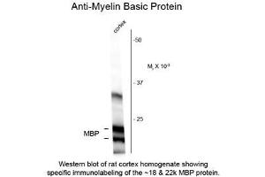 Image no. 1 for anti-Myelin Basic Protein (MBP) antibody (ABIN956786) (MBP antibody)