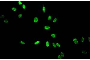Immunofluorescent analysis of Hela cells treated by NaB using ABIN7139158 at dilution of 1:100 and Alexa Fluor 488-congugated AffiniPure Goat Anti-Rabbit IgG(H+L) (HIST1H3A antibody  (acLys14))