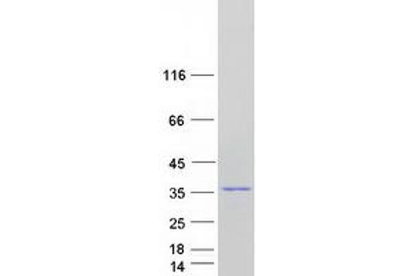 TCEAL3 Protein (Transcript Variant 1) (Myc-DYKDDDDK Tag)