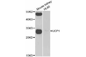 Western blot analysis of extracts of various cell lines, using UCP1 antibody. (UCP1 antibody)