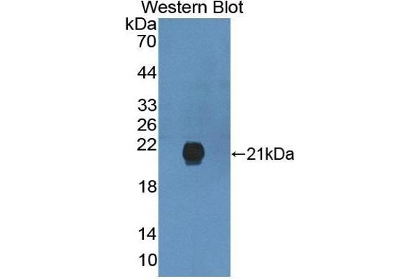 GREM2 antibody  (AA 22-168)