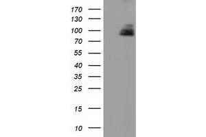 HEK293T cells were transfected with the pCMV6-ENTRY control (Left lane) or pCMV6-ENTRY PRKD2 (Right lane) cDNA for 48 hrs and lysed. (PKD2 antibody)