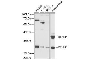 Western blot analysis of extracts of various cell lines, using KCNJ11 antibody (ABIN6129430, ABIN6142721, ABIN6142722 and ABIN6221442) at 1:1000 dilution. (KCNJ11 antibody  (AA 171-390))