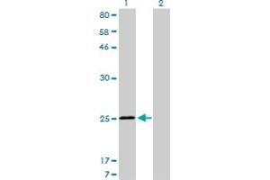 Western Blot analysis of TNNI3 expression in transfected 293T cell line by TNNI3 monoclonal antibody (M04), clone 1E7. (TNNI3 antibody  (AA 102-210))