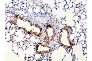 IHC analysis of MMP13 using anti-MMP13 antibody . (MMP13 antibody  (AA 99-335))