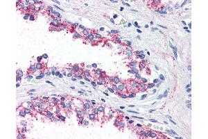 Anti-5HT1B Receptor antibody IHC of human prostate. (5HT1B Receptor antibody  (Internal Region))