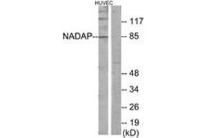 Western blot analysis of extracts from HuvEc cells, using NADAP Antibody. (NADAP antibody  (AA 421-470))