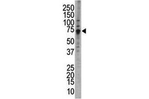 Western blot analysis of WEE1 antibody and HL-60 cell lysate; Predicted molecular weight ~72 kDa. (WEE1 antibody  (AA 604-634))