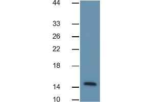 Western Blotting (WB) image for Fatty Acid Binding Protein 4, Adipocyte (FABP4) ELISA Kit (ABIN6730861)