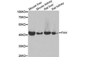 Western blot analysis of extracts of various cell lines, using FAH antibody. (FAH antibody)