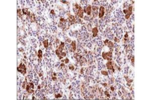 IHC testing of human pituitary gland stained with ACTH antibody (AH26). (ACTH antibody  (AA 1-24))