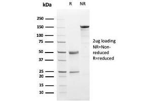 SDS-PAGE Analysis Purified Progesterone Receptor Mouse Monoclonal Antibody (PGR/2694). (Progesterone Receptor antibody  (AA 483-571))