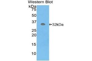 Western blot analysis of the recombinant protein. (PCK1 antibody  (AA 311-558))