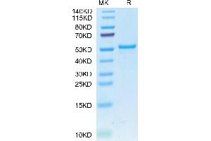 Cynomolgus CA9 on Tris-Bis PAGE under reduced condition. (CA9 Protein (AA 38-402) (His tag))