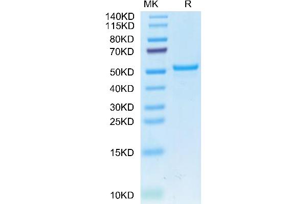 CA9 Protein (AA 38-402) (His tag)