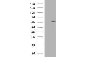 Western Blotting (WB) image for anti-Tubulin, alpha 1c (TUBA1C) antibody (ABIN1501555) (TUBA1C antibody)