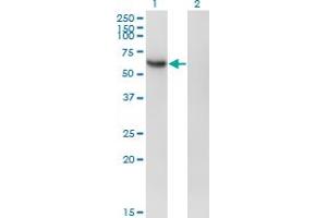 Western Blot analysis of RBPJ expression in transfected 293T cell line by RBPJ monoclonal antibody (M01A), clone 4E12. (RBPJ antibody  (AA 3-109))