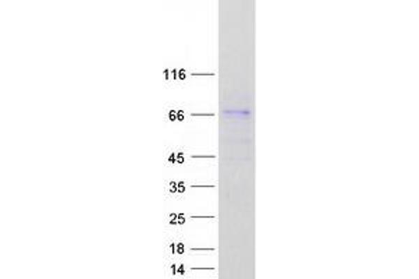 FBXL18 Protein (Myc-DYKDDDDK Tag)