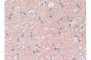 Used in DAB staining on fromalin fixed paraffin- embedded kidney tissue (UCP2 antibody  (AA 154-289))
