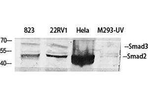 Western Blot analysis of 823 (1), 22RV1 (2), Hela (3), M293-UV (4), diluted at 1:500. (Smad2/3 antibody)