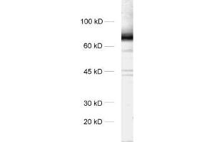 dilution: 1 : 1000, sample: rat brain homogenate (STXBP1 antibody)