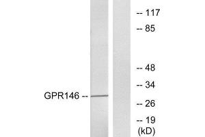 Western Blotting (WB) image for anti-G Protein-Coupled Receptor 146 (GPR146) (Internal Region) antibody (ABIN1852994) (GPR146 antibody  (Internal Region))