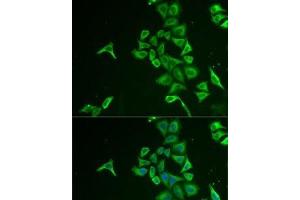 Immunofluorescence analysis of U2OS cells using INPP5J Polyclonal Antibody (INPP5J antibody)