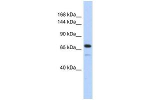Caldesmon 1 antibody used at 1 ug/ml to detect target protein. (Caldesmon antibody  (Middle Region))