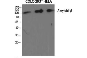 Western Blot analysis of various cells using Amyloid-β Polyclonal Antibody diluted at 1:2000. (beta Amyloid antibody)