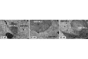 Image no. 2 for anti-Glutathione S-Transferase pi 1 (GSTP1) antibody (ABIN187491) (GSTP1 antibody)