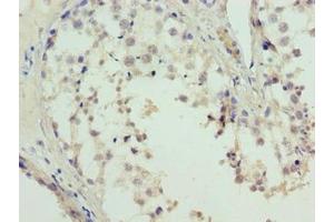 Immunohistochemistry of paraffin-embedded human testis tissue using ABIN7158010 at dilution of 1:100 (L3MBTL4 antibody  (AA 1-270))