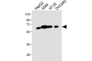 All lanes : Anti-CYP3A4 Antibody (Center) at 1:1000 dilution Lane 1: HepG2 whole cell lysate Lane 2: A549 whole cell lysate Lane 3: HT-29 whole cell lysate Lane 4: OVCAR3 whole cell lysate Lysates/proteins at 20 μg per lane. (CYP3A4 antibody  (AA 228-255))
