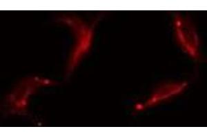 ABIN6277655 staining HepG2 by IF/ICC. (ICAM1 antibody  (C-Term))