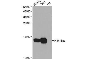 Western blot analysis of extracts of various cell lines, using Acetyl-Histone H3-K18 antibody (ABIN4903915) at 1:1000 dilution. (Histone 3 antibody  (H3K18ac))