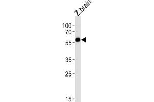 Western Blotting (WB) image for anti-Forkhead Box H1 (FOXH1) antibody (ABIN3004747) (FOXH1 antibody)