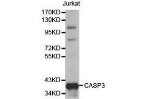 Western Blotting (WB) image for anti-Caspase 3 (CASP3) antibody (ABIN1871461) (Caspase 3 antibody)