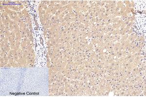 Immunohistochemical analysis of paraffin-embedded human liver tissue. (beta Catenin antibody)