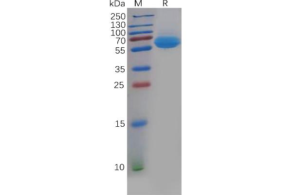 CD69 Protein (CD69) (Fc Tag)