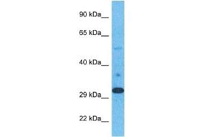 Host:  Rabbit  Target Name:  ELOV1  Sample Type:  Stomach Tumor lysates  Antibody Dilution:  1. (ELOVL1 antibody  (N-Term))