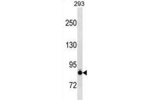 Western Blotting (WB) image for anti-K-Cadherin (CDH6) antibody (ABIN2997776) (CDH6 antibody)